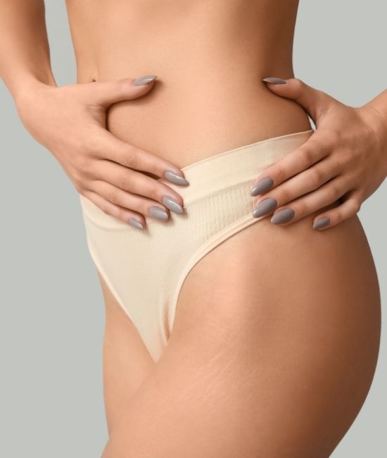 Abdominoplastia