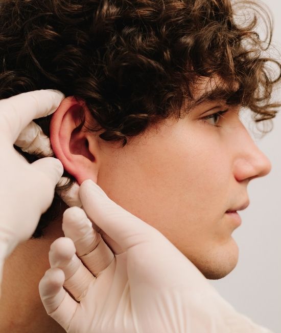 Otoplasty (Ear Surgery)