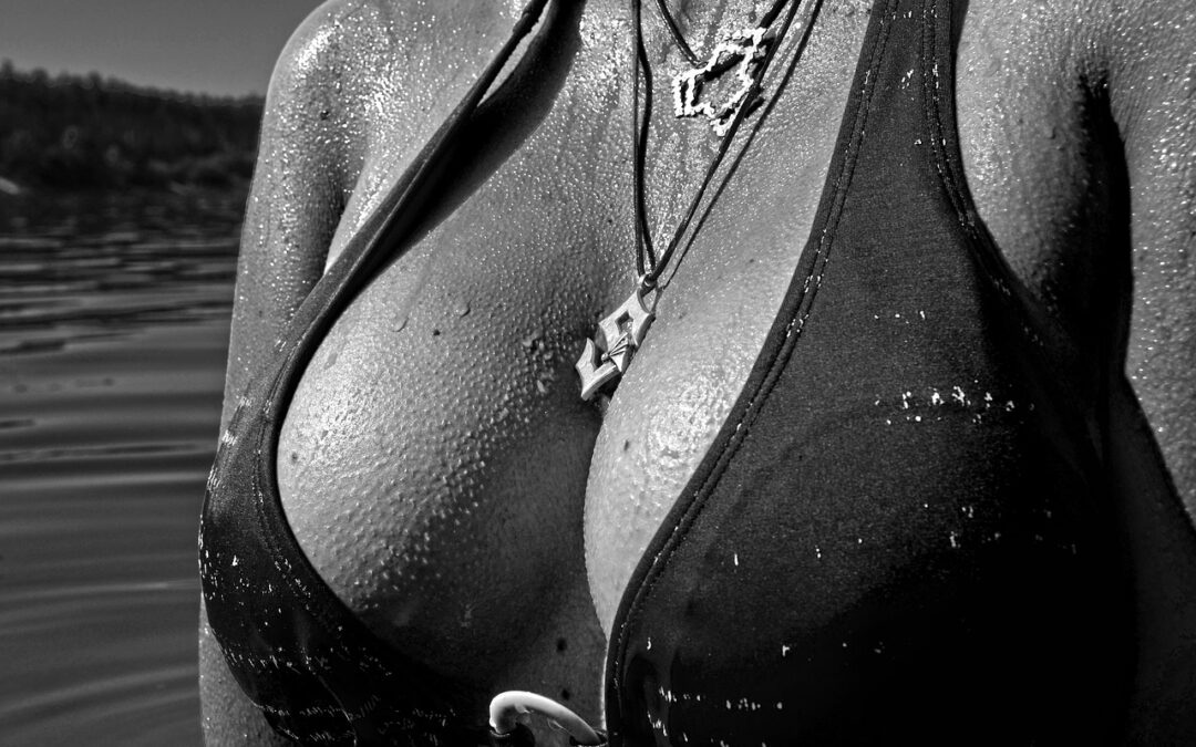 Comprehensive Insights into Breast Lift with BodyTite